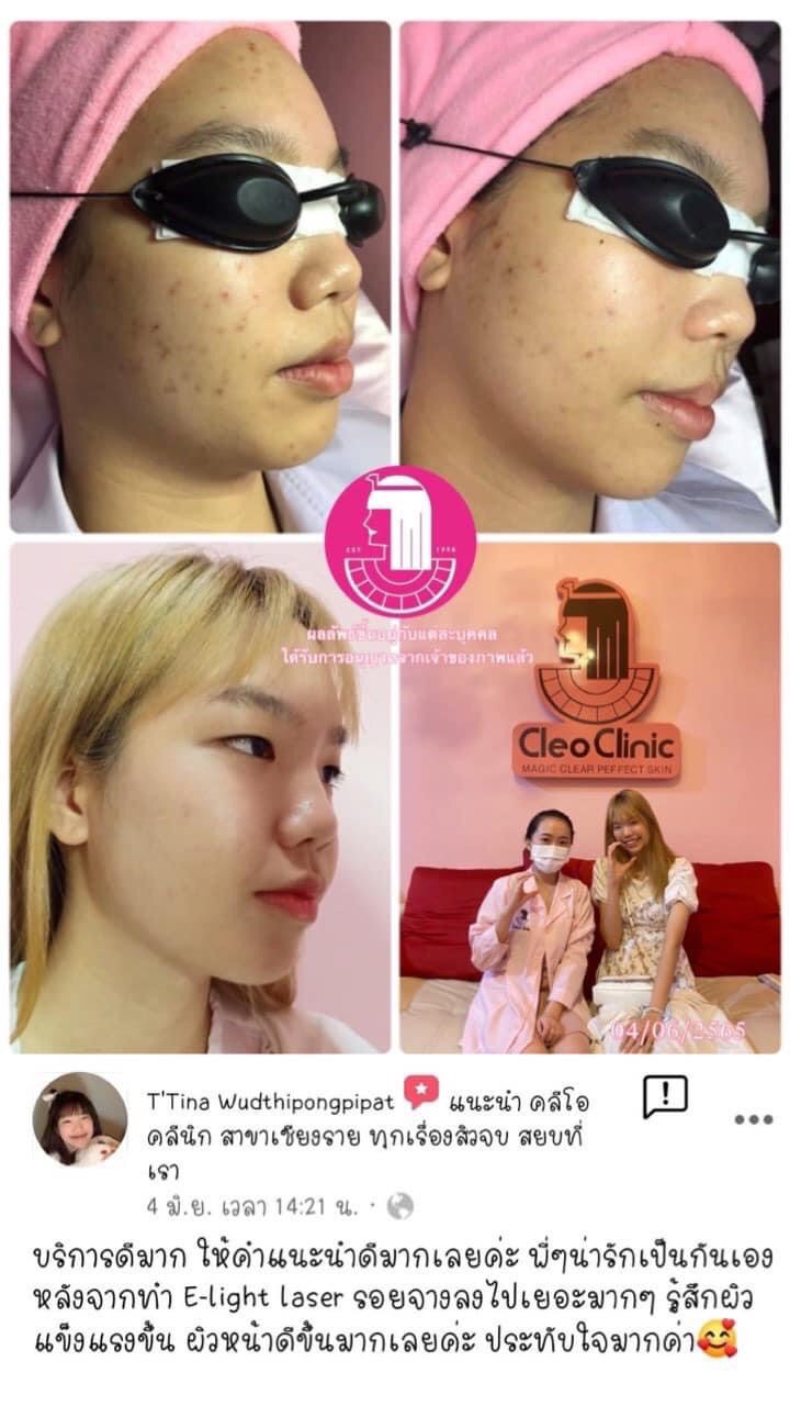 รีวิว ปี 62