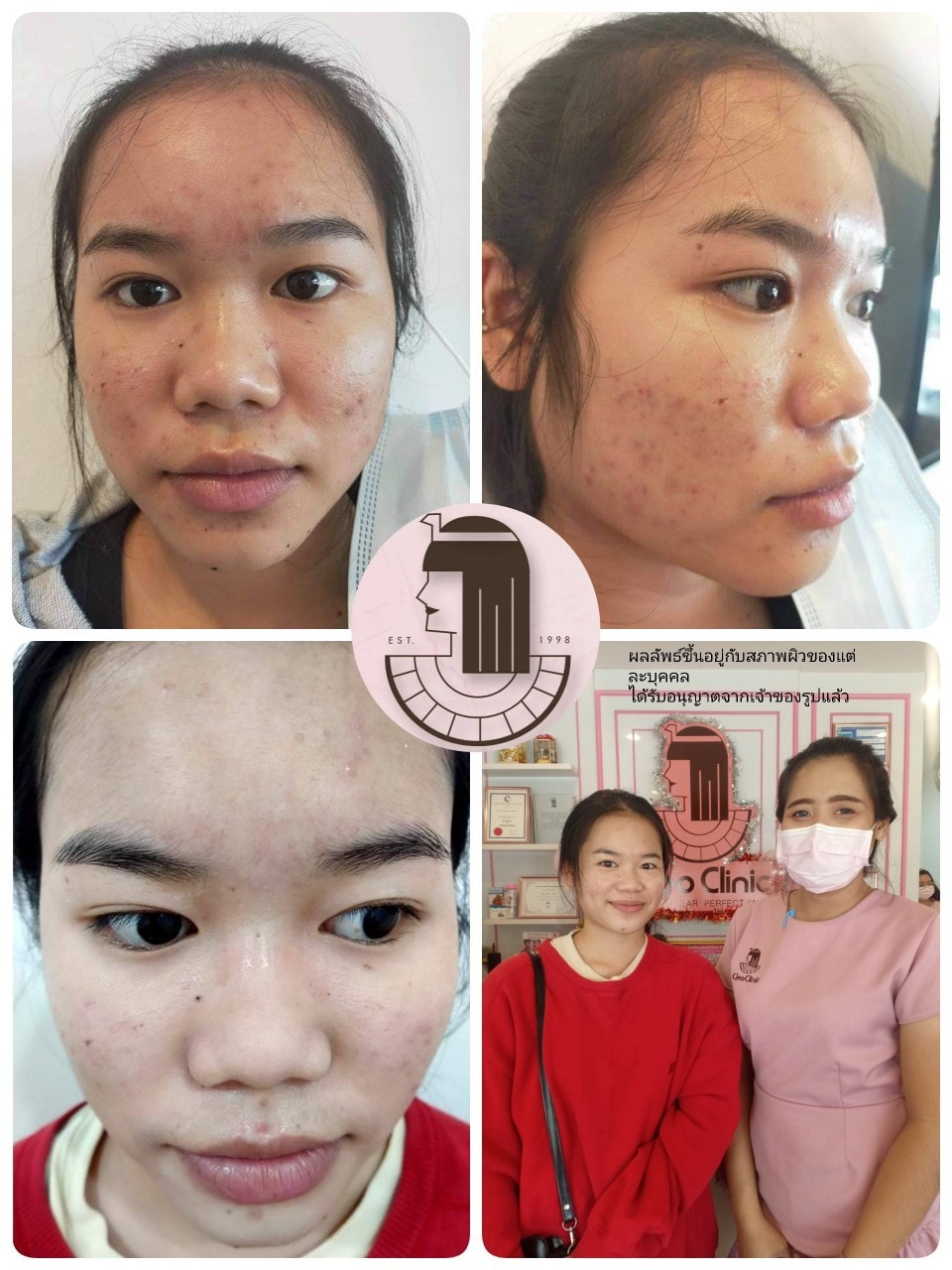 รีวิว ปี 62