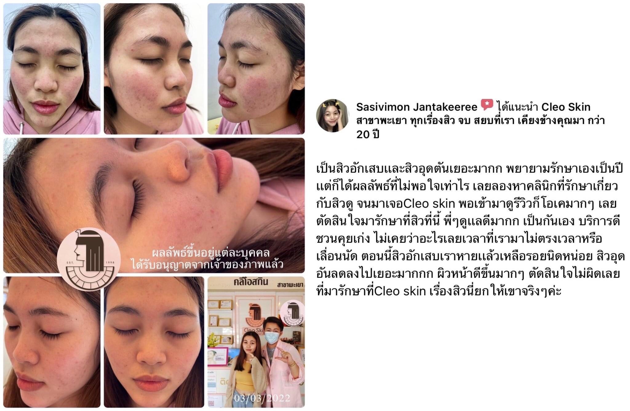 รีวิว ปี 62