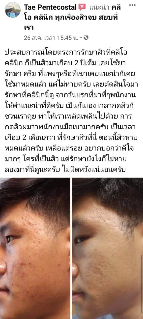 รีวิว ปี 62