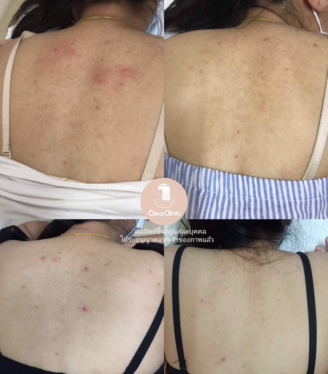 รีวิว ปี 62