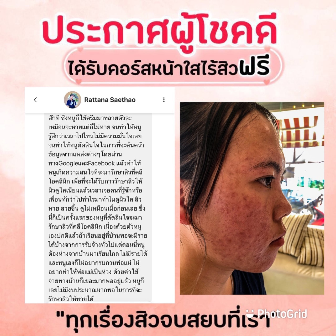 รีวิว ปี 62