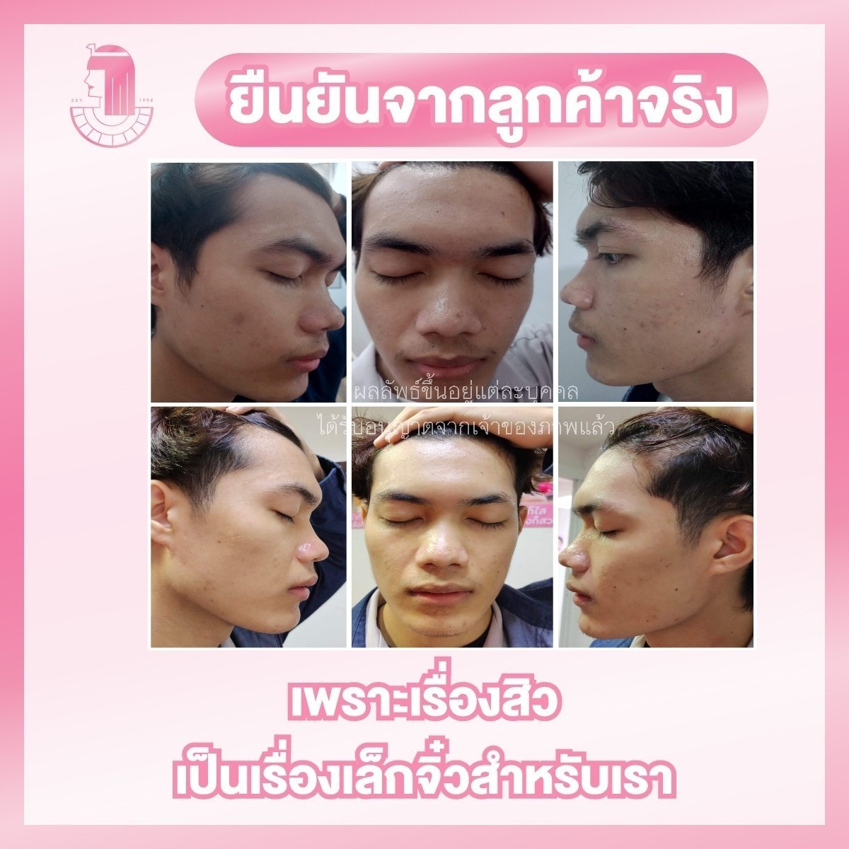 รีวิว ปี 62