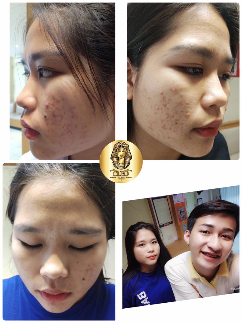 รีวิว ปี 62