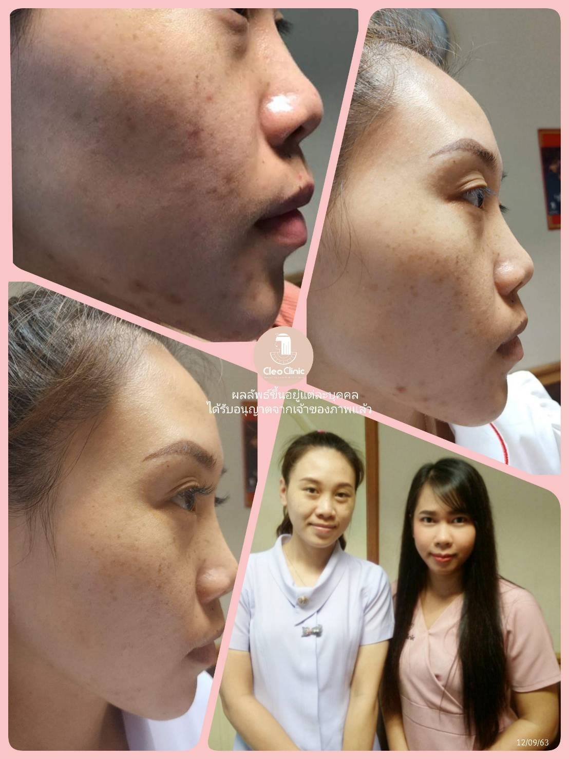 รีวิว ปี 62