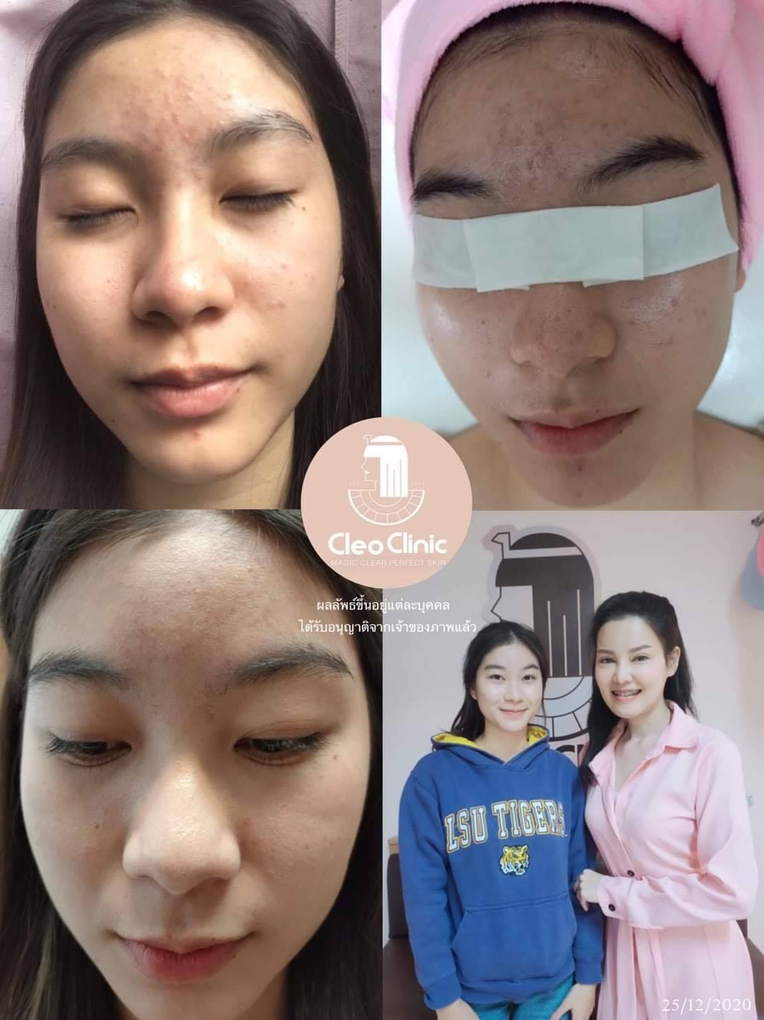 รีวิว ปี 62