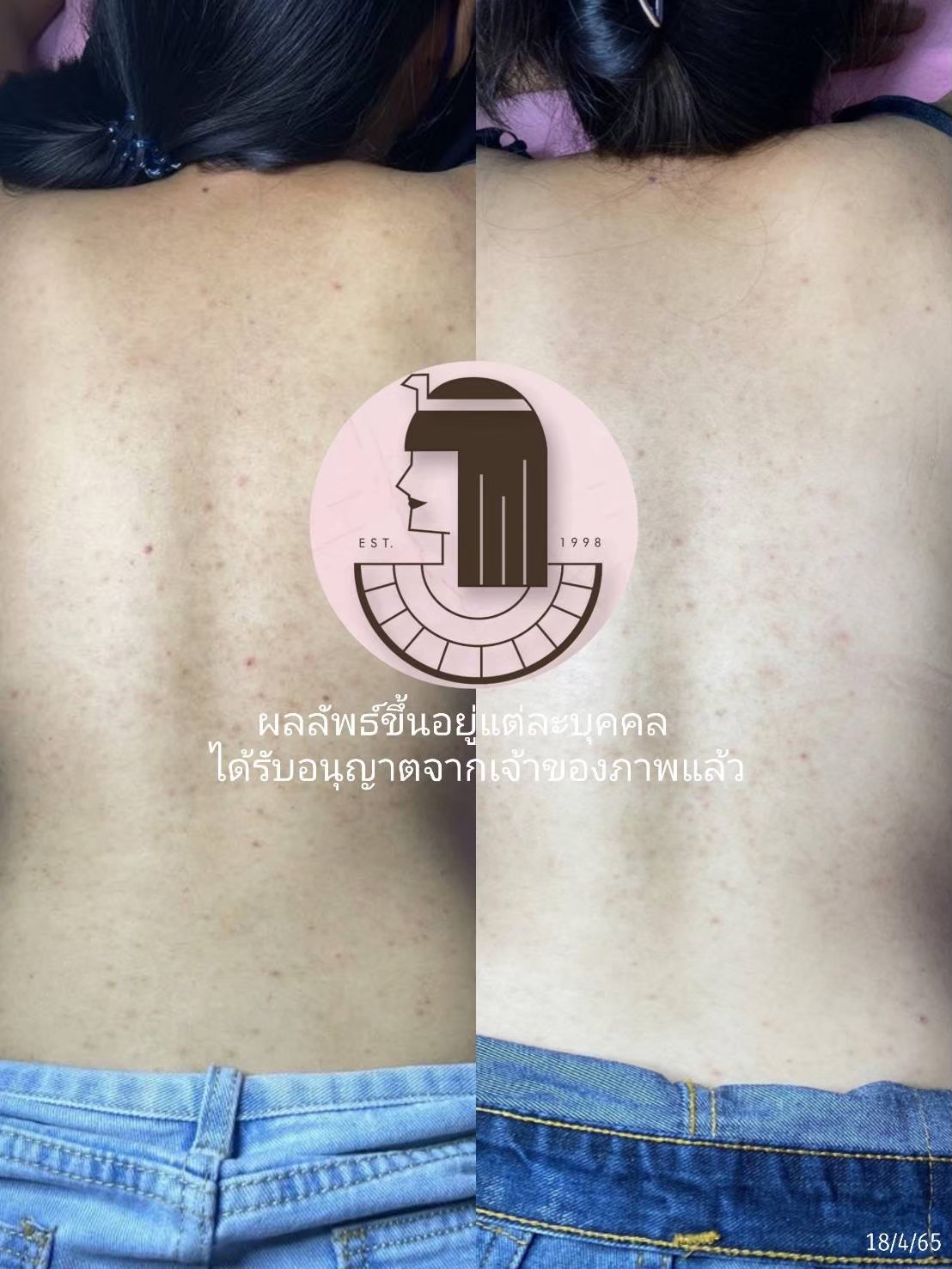 รีวิว ปี 62