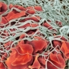ไฟบริน(Fibrin)..เพื่อตอบคำถามที่ว่า..หนูมีแผลผ่าตัดหลังคลอดต้องแก้อย่างไรคะ