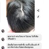 ผมแหว่ง