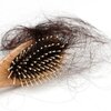 ผมร่วง (alopecia)