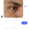 ตากุ้งยิง