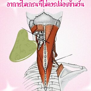 หัวตึง ปวดจี๊ด ตาพร่า อาการไมเกรนที่ไม่ควรปล่อยข้ามวัน!